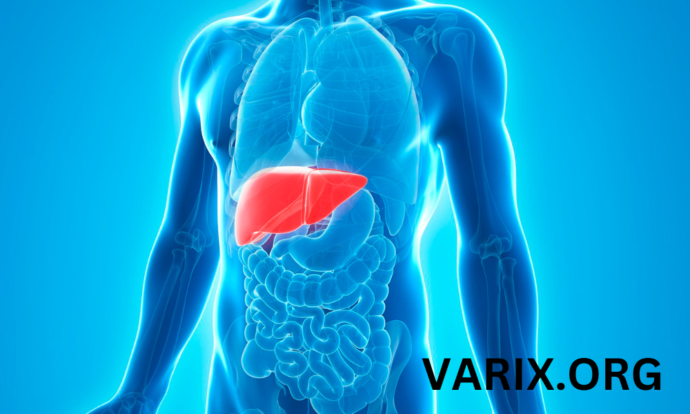 esophageal-varices-causes-symptoms-treatment